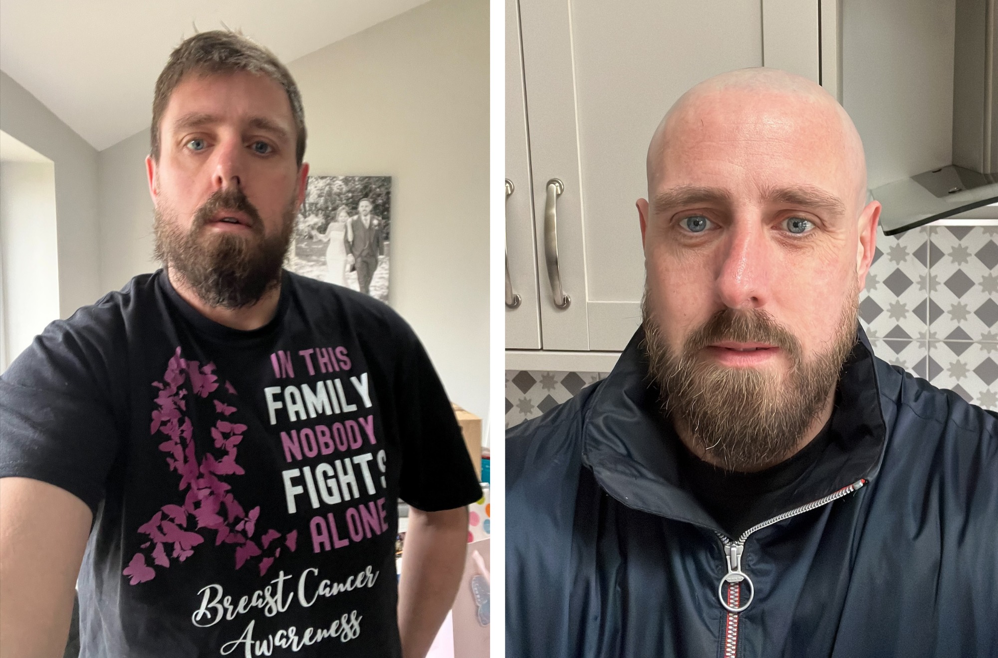 Brother shaves his head for sister to help Breast Cancer Now | Warrington  Guardian